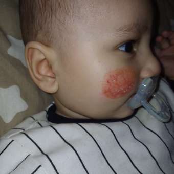 Смесь сухая Nutrilon Пепти аллергия 400г с 0 месяцев: отзыв пользователя Детский Мир