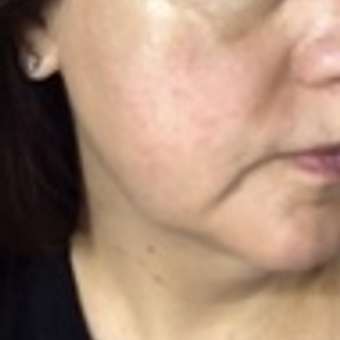 Коллаген морской порошок UltraBalance низкомолекулярный Collagen Tripeptide БАД 30саше с витамином С и гиалуроновой кислотой: отзыв пользователя Детский Мир
