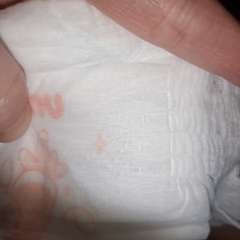 Фото отзыва 10699136