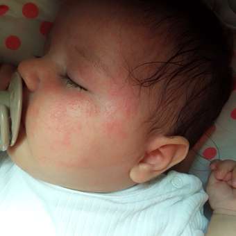 Смесь сухая Nutrilon Пепти Гастро 450г с 0 месяцев: отзыв пользователя Детский Мир