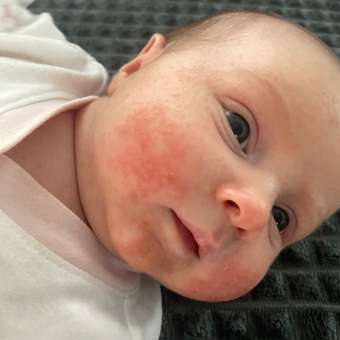 Смесь NAN Антиаллергия 400г с 0месяцев: отзыв пользователя ДетМир