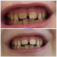 Фото отзыва 10601098