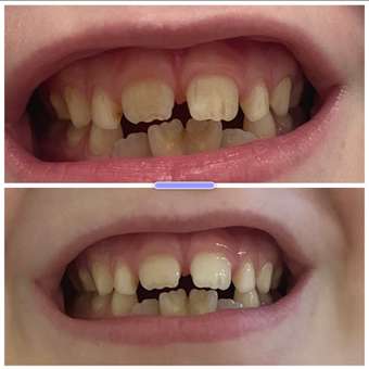 Зубная паста Curaprox с фтором Миссис Арбуз: отзыв пользователя Детский Мир