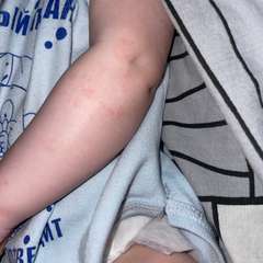 Фото отзыва 10993338