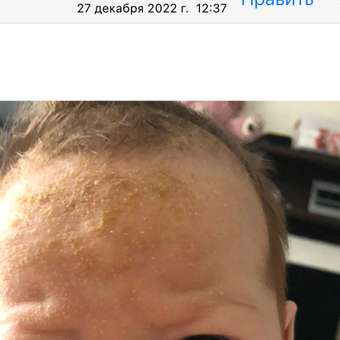 Шампунь Baby Balance от молочных корочек 250 мл: отзыв пользователя ДетМир