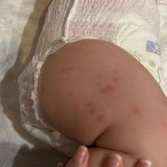 Фото отзыва 11301282