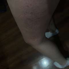 Фото отзыва 11151372