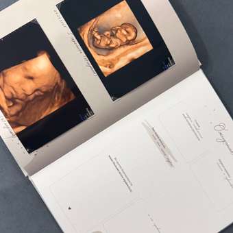 Фотоальбом-дневник Moms Recordbook История детства: отзыв пользователя Детский Мир