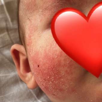 Смесь сухая Nutrilon безлактозная 400г с 0 месяцев: отзыв пользователя Детский Мир