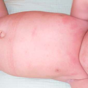 Смесь сухая Nutrilon Пепти Гастро 450г с 0 месяцев: отзыв пользователя Детский Мир