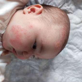 Смесь Nutricia Neocate LCP для детей с пищевой аллергией 400г c 0месяцев: отзыв пользователя Детский Мир